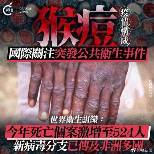世卫组织宣布猴痘疫情构成“国际关注的突发公共卫生事件”