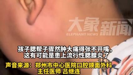 儿童“腮帮子”肿就是流行性腮腺炎吗?