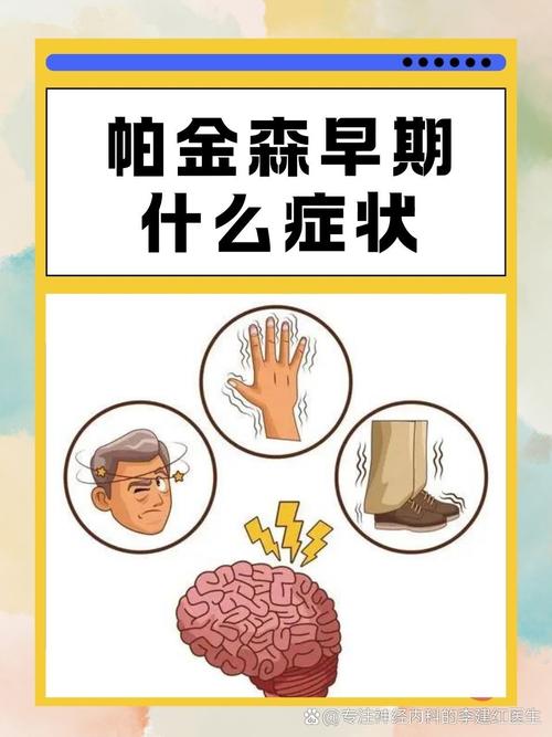 单克隆抗体能减缓快速发展型帕金森病