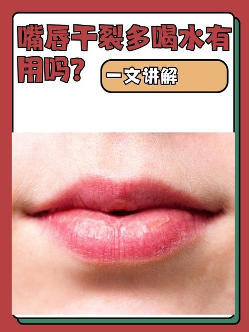 嘴唇干裂别急着喝水,可能是缺这种维生素!80%都忽略了,难怪好得慢!