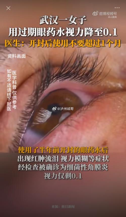 27岁姑娘视力仅剩0.1,悔惨了!很多人正在用